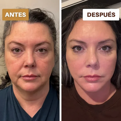 Valetta™ Cepillo facial linfático